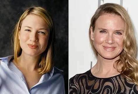 Renee Zellweger