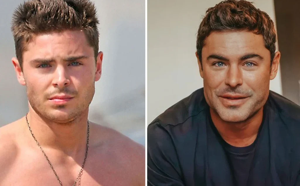 Zac Efron